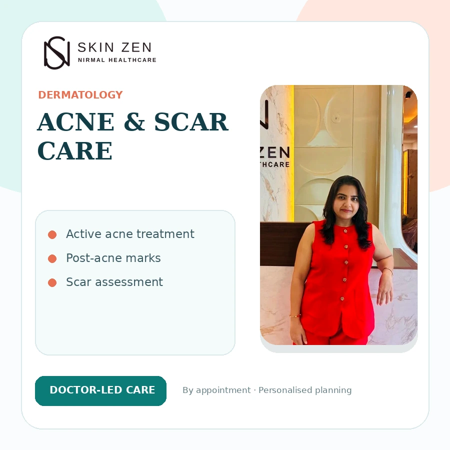 Acne and Acne Scar Treatment in Faridabad at Skinzen Faridabad
